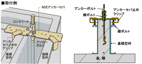 M式アンカーセパ